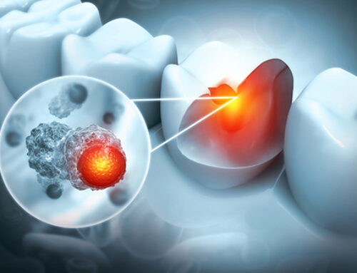 Fixing a tooth infection may improve blood sugar and heart health