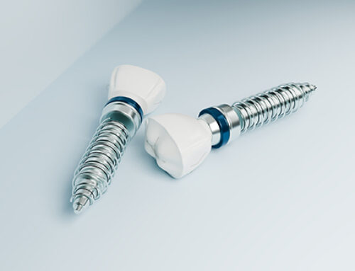 Titanium particles linked to antibiotic failure in peri-implantitis